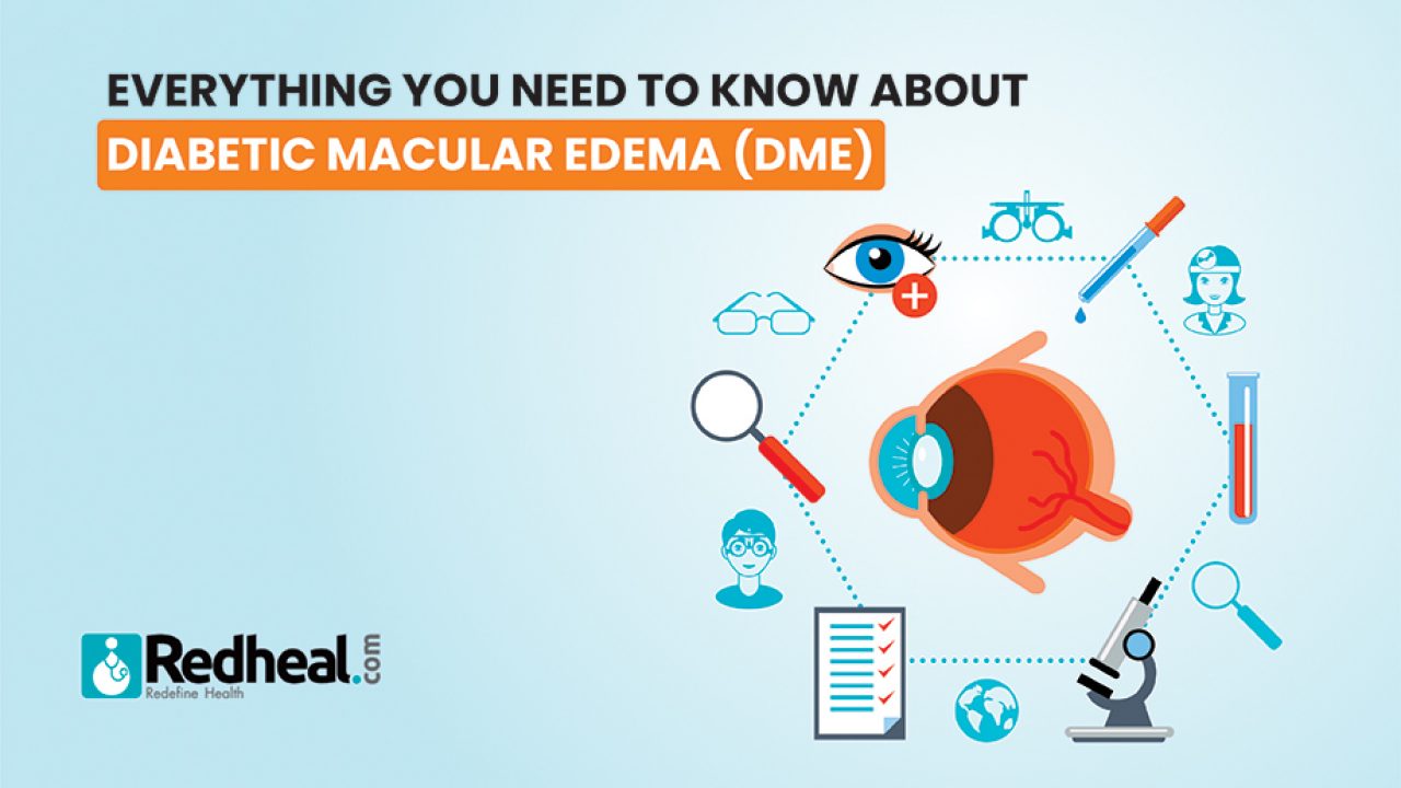 What is DME? Symptoms, Cause & Impact